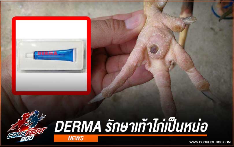 Derma (เดอร์มา) รักษาเท้าไก่เป็นหน่อ สำหรับไก่ชน โดยเฉพาะ